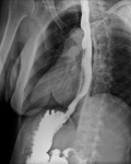 Rx apparato digente con MdC