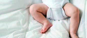Ecografia dell'anca neonatale