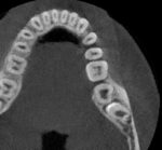 TC-Cone Beam