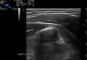 Ecografia osteoarticolare
