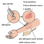 Prick Test