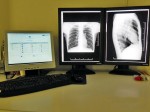 Radiologia Digitale, RIS e PACS